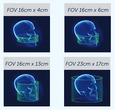 V17 Has The Largest Range of Field-Of-View